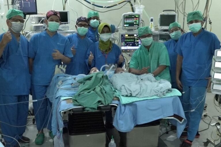 Bayi Kembar Siam Asal Karanganyar Berhasil Dipisahkan Di RSUD dr Moewardi