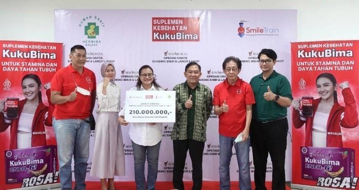 Lagi, Sido Muncul Gelar Operasi Bibir Sumbing Gratis