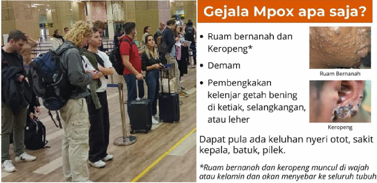 Warga Brebes Positif Suspek Cacar Monyet Diisolasi di RSUD
