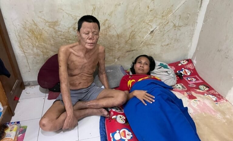 Nengok Budiono, Mantan Pemain PSIS yang Kini Hidup Susah 